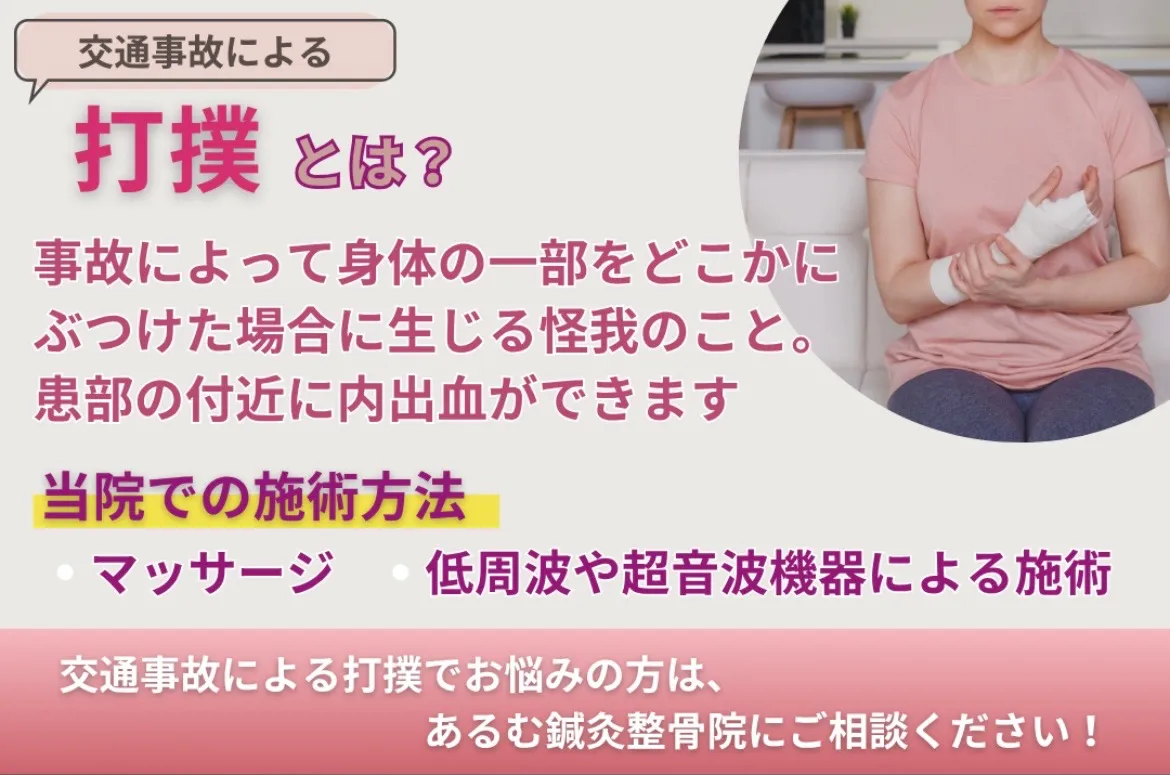 【交通事故による打撲とは？】放っておかないで！整骨院でできる早期ケア｜北諸県郡三股町・あるむ鍼灸整骨院