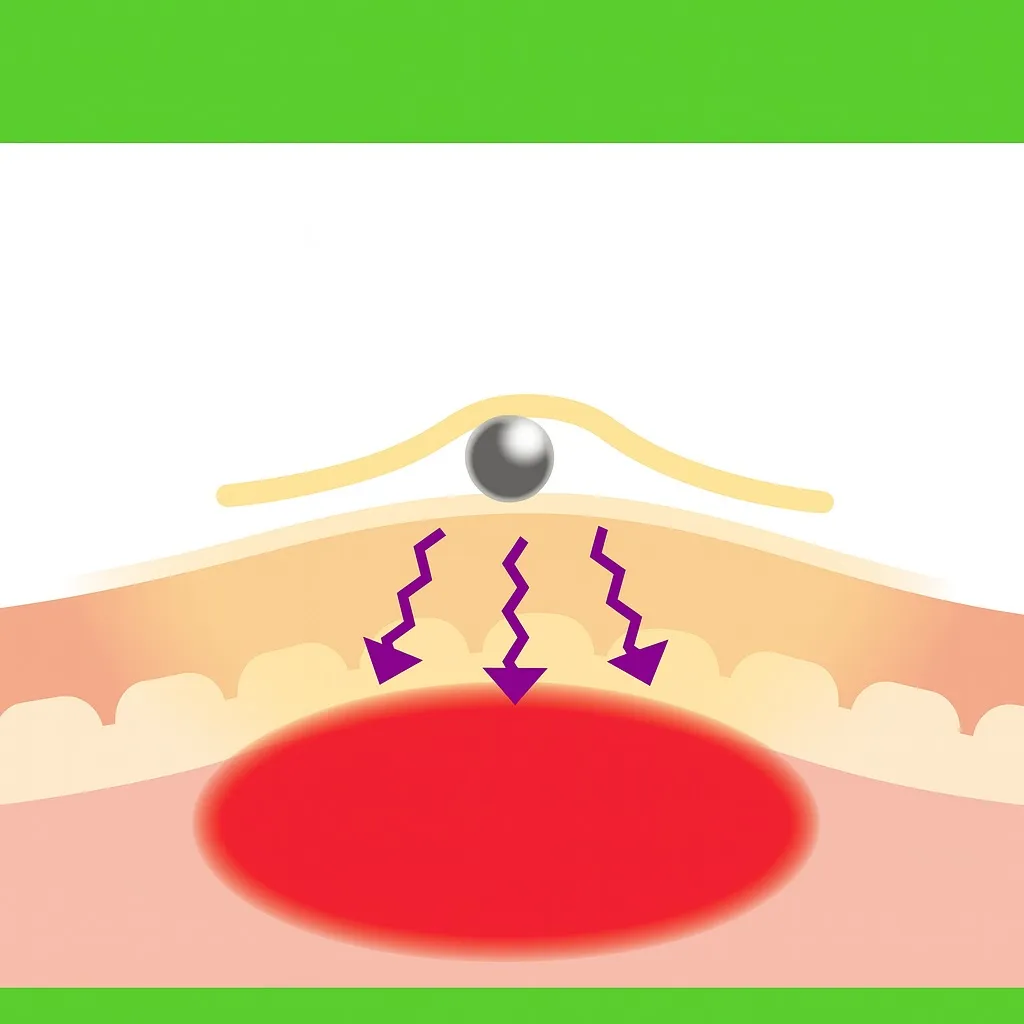 ✨耳ツボダイエット✨