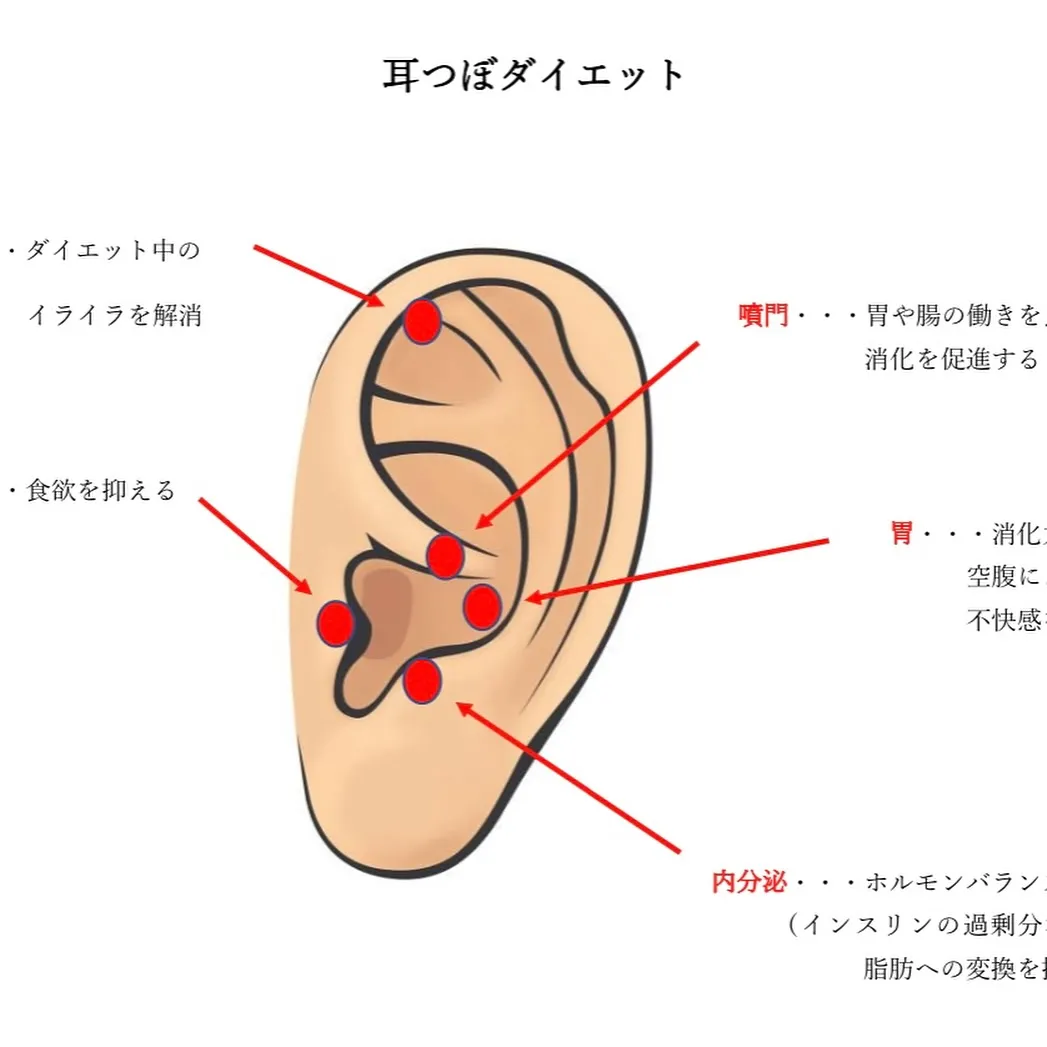 ✨耳ツボダイエット✨