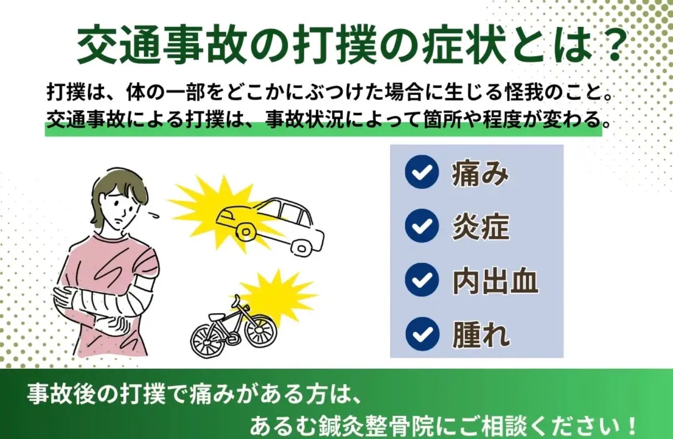 【交通事故による打撲とは？】