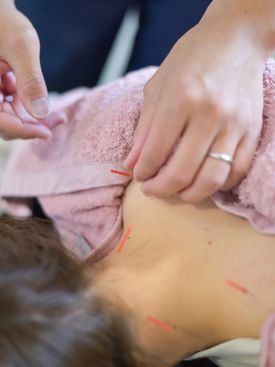 今日は、14名の方に鍼灸施術を行いました☺️🪡